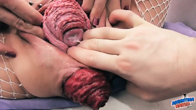 Hardcore and prolapse