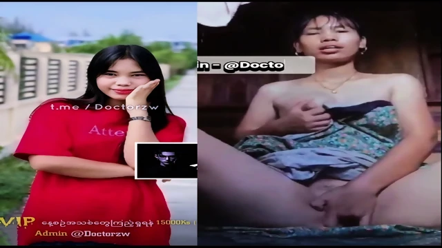 Before After Version