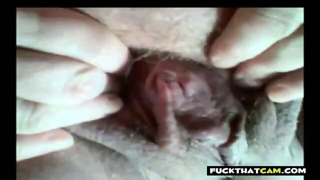 French Aunty's Private Gyno Cam Exam